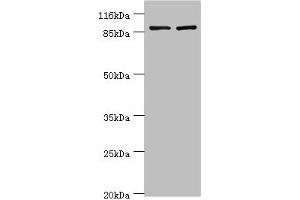 Western blot All lanes: GCC1 antibody at 2 μg/mL Lane 1: Hela whole cell lysate Lane 2: 293T whole cell lysate Secondary Goat polyclonal to rabbit IgG at 1/10000 dilution Predicted band size: 88 kDa Observed band size: 88 kDa (GCC1 抗体  (AA 4-775))