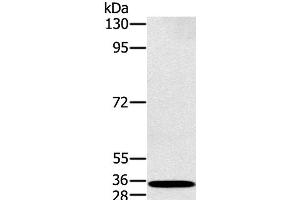 Western Blot analysis of K562 cell using RAB27A Polyclonal Antibody at dilution of 1:400 (RAB27A 抗体)