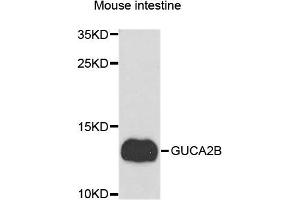 Western blot analysis of extracts of Mouse intestine cells, using GUCA2B antibody. (GUCA2B 抗体)