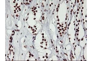 Immunohistochemical staining of paraffin-embedded Human Kidney tissue using anti-GSTT2 mouse monoclonal antibody. (GSTT2 抗体)