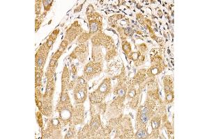 Immunohistochemistry of paraffin-embedded mouse testis using CD47 Rabbit pAb (ABIN3022623, ABIN3022624, ABIN3022625, ABIN1512716 and ABIN6218964) at dilution of 1:100 (40x lens). (CD47 抗体  (AA 20-140))