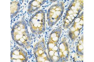 Immunohistochemistry of paraffin-embedded Rat intestine using HGF Polyclonal Antibody at dilution of 1:100 (40x lens). (HGF 抗体)