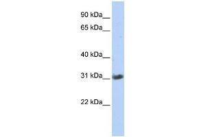 WB Suggested Anti-ZFAND3 Antibody Titration:  0. (ZFAND3 抗体  (Middle Region))