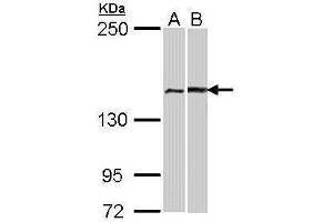 WB Image Sample (30 ug of whole cell lysate) A: A431 , B: Hela 12% SDS PAGE antibody diluted at 1:1000