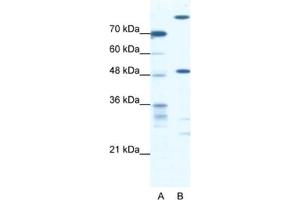 Western Blotting (WB) image for anti-NFS1, Cysteine Desulfurase (NFS1) antibody (ABIN2460657) (NFS1 抗体)