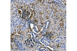 IHC analysis of ASS1 using anti-ASS1 antibody (ABIN7601191). (ASS1 抗体  (AA 3-365))