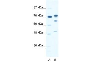 Western Blotting (WB) image for anti-DEAD (Asp-Glu-Ala-Asp) Box Polypeptide 21 (DDX21) antibody (ABIN2461343) (DDX21 抗体)