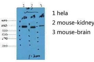 Western Blot (WB) analysis of 1) HeLa, 2) Mouse Kidney, 3) Mouse Brain, diluted at 1:2000. (Cytokeratin 7 抗体)