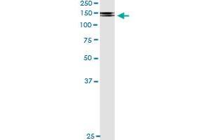 Immunoprecipitation (IP) image for anti-Platelet Derived Growth Factor Receptor beta (PDGFRB) (AA 33-133) antibody (ABIN518746)