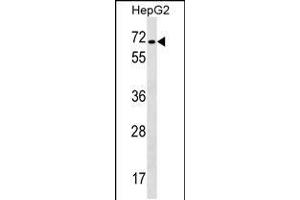 Western blot analysis in HepG2 cell line lysates (35ug/lane). (CACNB1 抗体  (C-Term))