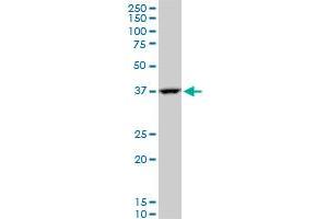 GOT2 polyclonal antibody (A01), Lot # FHC0061120QCS1. (GOT2 抗体  (AA 331-430))