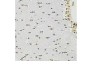 Immunohistochemistry of paraffin-embedded rat brain using RBPJ Antibody (ABIN1876876) at dilution of 1:100 (40x lens). (RBPJ 抗体)