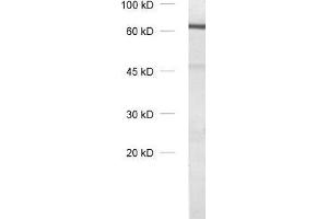 dilution: 1 : 1000, sample: olfactory bulb homogenate (Tyrosine Hydroxylase 抗体)