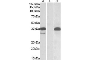HEK293 lysate (10ug protein in RIPA buffer) overexpressing Human PIM2 with C-terminal MYC tag probed with ABIN1590101 (0. (PIM2 抗体  (C-Term))