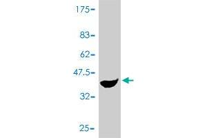 Western Blot detection against Immunogen (37.