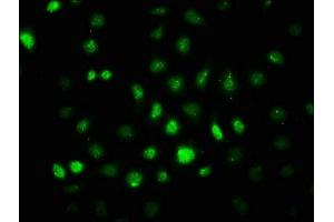 Immunofluorescence staining of A549 cells with ABIN7127692 at 1:100,counter-stained with DAPI. (Recombinant PRKAA2 抗体  (pThr172))