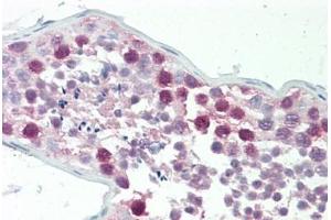 Immunohistochemistry (IHC) image for anti-Cleavage Stimulation Factor, 3' Pre-RNA, Subunit 1, 50kDa (CSTF1) (AA 1-50) antibody (ABIN2879399)
