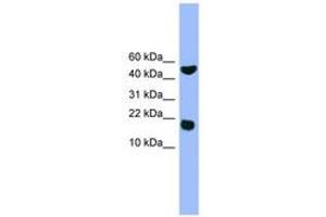 Image no. 1 for anti-RWD Domain Containing 1 (RWDD1) (AA 41-90) antibody (ABIN6746575) (RWDD1 抗体  (AA 41-90))
