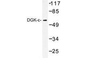 Western blot analysis of DGK-ε antibody in extracts from K562 cells. (DGKE 抗体)