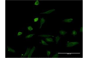 Immunofluorescence of monoclonal antibody to IL1A on HeLa cell.