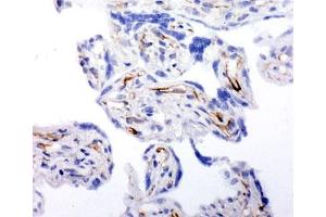 Immunohistochemistry (IHC) image for anti-Hydroxysteroid (17-Beta) Dehydrogenase 2 (HSD17B2) (AA 373-387) antibody (ABIN3031272)