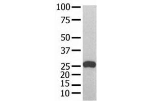 GST Tag antibody used in western blot with recombinant protein (GST-Tag 抗体)