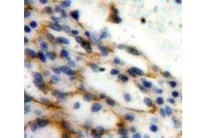 Used in DAB staining on fromalin fixed paraffin-embedded Spleen tissue (P-Selectin 抗体  (AA 58-195))