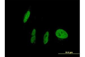 Immunofluorescence (IF) image for anti-Nuclear Receptor Subfamily 1, Group I, Member 2 (NR1I2) (AA 1-434) antibody (ABIN950157)