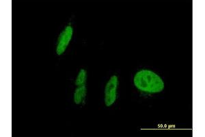 Immunofluorescence of purified MaxPab antibody to NR1I2 on HepG2 cell. (NR1I2 抗体  (AA 1-434))
