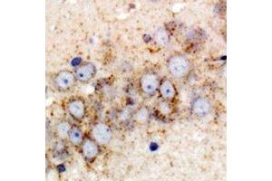 Immunohistochemical analysis of GPI staining in rat brain formalin fixed paraffin embedded tissue section. (GPI 抗体)