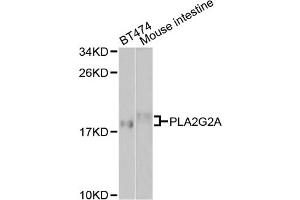 Western blot analysis of extracts of various cell lines, using PLA2G2A antibody. (PLA2G2A 抗体)