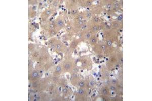 Formalin fixed, paraffin embedded human liver tissue stained with SIX5 Antibody  followed by peroxidase conjugation of the secondary antibody and DAB staining. (Six5 抗体  (Middle Region))