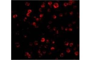 Immunofluorescence (IF) image for anti-CASP2 and RIPK1 Domain Containing Adaptor with Death Domain (CRADD) (AA 99-117), (Middle Region) antibody (ABIN500561)