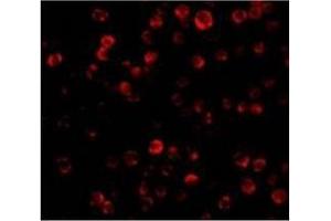 Immunofluorescence of RAIDD in Hela cells with RAIDD antibody at 20 µg/ml. (CRADD 抗体  (Middle Region))