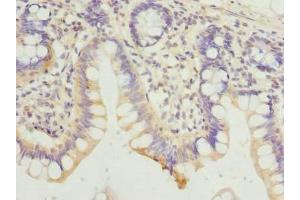Immunohistochemistry of paraffin-embedded human small intestine tissue using ABIN7154822 at dilution of 1:100 (HDHD3 抗体  (AA 1-251))