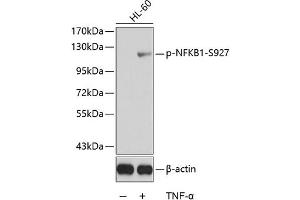 Western blot analysis of extracts from HL60 cells using Phospho-NFKB1-S927 antibody (ABIN3019967, ABIN3019968, ABIN3019969 and ABIN6225499).