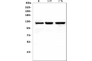 Western blot analysis of NLRP2 using anti-NLRP2 antibody (ABIN6719345). (NLRP2 抗体  (AA 9-190))