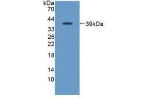 Detection of Recombinant Protein RPA096Ca01 with GST-tag using Anti-Glutathione S Transferase (GST) Tag Polyclonal Antibody (GST 抗体  (AA 1-218))