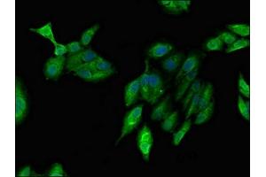 Immunofluorescent analysis of Hela cells using ABIN7143442 at dilution of 1:100 and Alexa Fluor 488-congugated AffiniPure Goat Anti-Rabbit IgG(H+L) (ARF1 抗体  (AA 2-181))