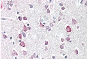 Human Brain, Cortex: Formalin-Fixed, Paraffin-Embedded (FFPE)