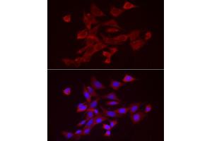 Immunofluorescence analysis of NIH/3T3 cells using  Rabbit pAb (ABIN7265439) at dilution of 1:25 (40x lens). (ADAMTS1 抗体  (AA 718-967))
