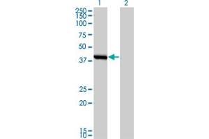 Western Blot analysis of SMS expression in transfected 293T cell line by SMS monoclonal antibody (M01), clone 1G6. (SMS 抗体  (AA 1-366))