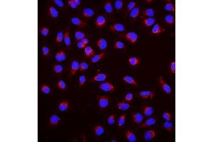 IF analysis of SGK1 using anti-SGK1 antibody (ABIN7603118).
