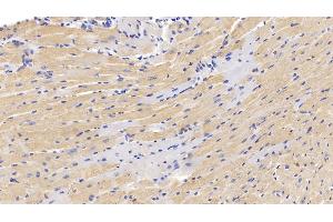 Detection of MUC5AC in Mouse Cardiac Muscle Tissue using Polyclonal Antibody to Mucin 5 Subtype AC (MUC5AC) (MUC5AC 抗体  (AA 430-549))