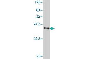 Western Blot detection against Immunogen (38. (TNNI3 抗体  (AA 102-210))