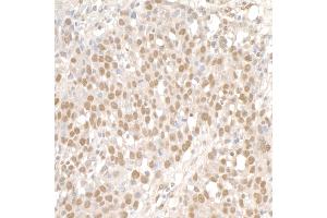 Immunohistochemistry (IHC) image for anti-Structural Maintenance of Chromosomes 1A (SMC1A) (C-Term) antibody (ABIN7453928) (SMC1A 抗体  (C-Term))