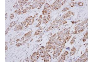 Immunohistochemistry (IHC) image for anti-NADH Dehydrogenase (Ubiquinone) 1 alpha Subcomplex, 10, 42kDa (NDUFA10) (Center) antibody (ABIN2856963)