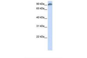 Image no. 1 for anti-Erythrocyte Membrane Protein Band 4.1 (Elliptocytosis 1, RH-Linked) (EPB41) (AA 74-123) antibody (ABIN6738044)