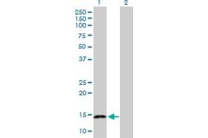 Western Blot analysis of NFATC2IP expression in transfected 293T cell line by NFATC2IP MaxPab polyclonal antibody. (NFATC2IP 抗体  (AA 1-138))