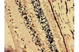 Immunohistochemistry analysis of human eye tissue using ABIN7145466 at dilution of 1:100 (CRYbA4 抗体  (AA 2-196))
